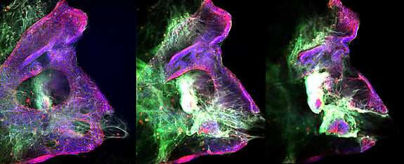 3D Organoid long