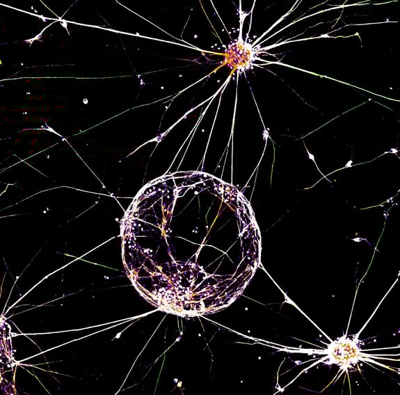 Neuro social post-1