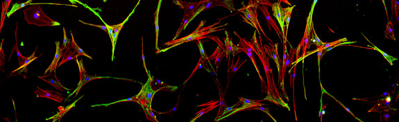 lung-fibrosis-lpwebpage-banner-image