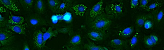 mitohealth-lpwebpage-banner-image-v2