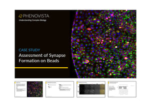 synapse-formation-on-beads-thumbnail