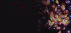 lipid-banner